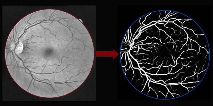RetinaLiteNet: Medical Image Segmentation & Disease Classification